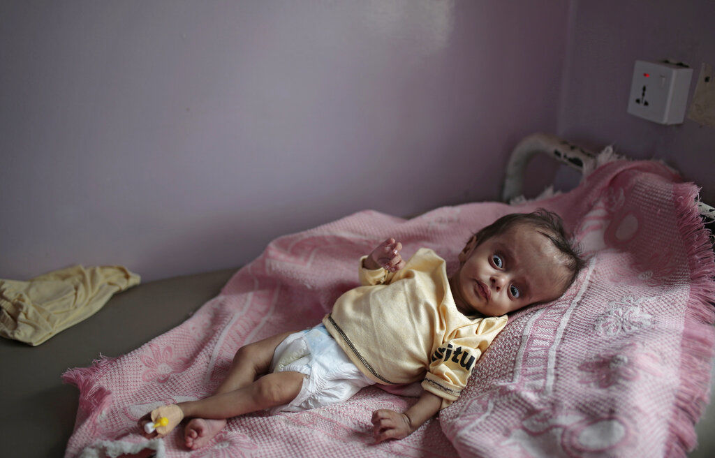 APTOPIX Yemen